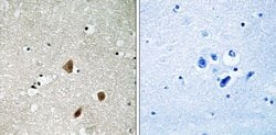 Phospho-PAK3 (Ser154) Polyclonal Antibody, Invitrogen 100 &mu;g; Unconjugated:Anticuerpos