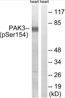 Phospho-PAK3 (Ser154) Polyclonal Antibody, Invitrogen 100 &mu;g; Unconjugated:Anticuerpos