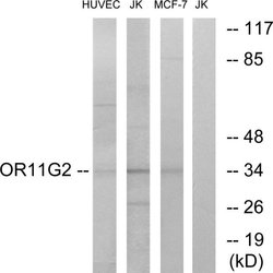 OR11G2 Polyclonal Antibody, Invitrogen 100 &mu;g; Unconjugated:Antibodies