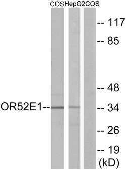 OR52E1 Polyclonal Antibody, Invitrogen 100 &mu;g; Unconjugated:Antibodies