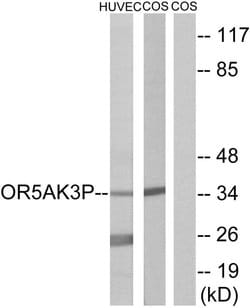 OR5AK3P Polyclonal Antibody, Invitrogen 100 &mu;g; Unconjugated:Antibodies,