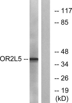 OR2L5 Polyclonal Antibody, Invitrogen 100 &mu;g; Unconjugated:Antibodies,