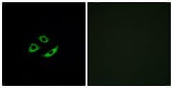 OR4C12 Polyclonal Antibody, Invitrogen 100 &mu;g; Unconjugated:Antibodies,
