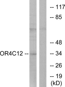 OR4C12 Polyclonal Antibody, Invitrogen 100 &mu;g; Unconjugated:Antibodies,