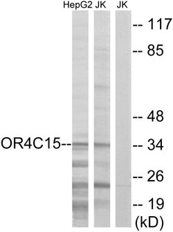 OR4C15 Polyclonal Antibody, Invitrogen 100 μg; Unconjugated:Antibodies,