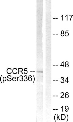 Phospho-CCR5 (Ser336) Polyclonal Antibody, Invitrogen 100 &mu;g | Buy Online | Invitrogen | Fisher Scientific