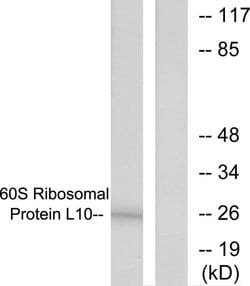 RPL10 Polyclonal Antibody, Invitrogen 100 &mu;g; Unconjugated:Antibodies,
