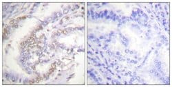 Phospho-Ku70 (Ser5) Polyclonal Antibody, Invitrogen 100 &mu;g; Unconjugated:Antibodies,