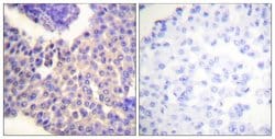 Phospho-beta Arrestin 1 (Ser412) Polyclonal Antibody, Invitrogen 100 &mu;g;