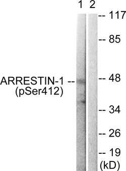 Phospho-beta Arrestin 1 (Ser412) Polyclonal Antibody, Invitrogen 100 &mu;g;