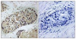 Phospho-Artemis (Ser516) Polyclonal Antibody, Invitrogen 100 &mu;g; Unconjugated:Antibodies,