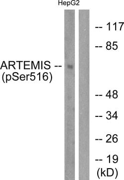 Phospho-Artemis (Ser516) Polyclonal Antibody, Invitrogen 100 &mu;g; Unconjugated:Antibodies,
