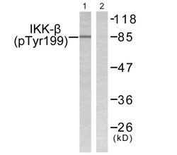 Phospho-IKK beta (Tyr199) Polyclonal Antibody, Invitrogen 100 &mu;g; Unconjugated:Antibodies,