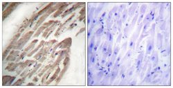 Phospho-NFATC1 (Ser294) Polyclonal Antibody, Invitrogen 100 &mu;g; Unconjugated:Antibodies,
