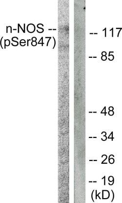 Phospho-nNOS (Ser852) Polyclonal Antibody, Invitrogen 100 &mu;g; Unconjugated:Antibodies,