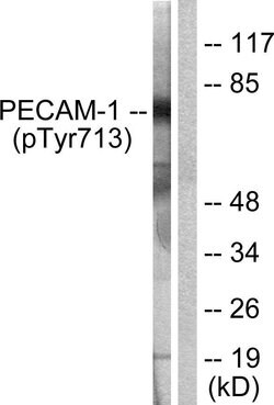 Phospho-CD31 (Tyr713) Polyclonal Antibody, Invitrogen 100 &mu;g | Buy Online | Invitrogen | Fisher Scientific