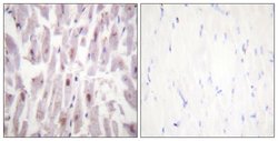 Phospho-TRAP220 (Thr1457) Polyclonal Antibody, Invitrogen 100 &mu;g | Buy Online | Invitrogen | Fisher Scientific