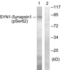 Phospho-Synapsin 1 (Ser62) Polyclonal Antibody, Invitrogen 100 &mu;g | Buy Online | Invitrogen | Fisher Scientific