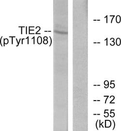Phospho-TEK (Tyr1108) Polyclonal Antibody, Invitrogen 100 &mu;g; Unconjugated:Anticuerpos