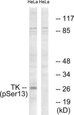 Phospho-TK1 (Ser13) Polyclonal Antibody, Invitrogen 100 &mu;g; Unconjugated:Antibodies,