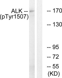 Phospho-ALK (Tyr1507) Polyclonal Antibody, Invitrogen 100 &mu;g | Buy Online | Invitrogen | Fisher Scientific