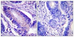 Phospho-eIF4B (Ser422) Polyclonal Antibody, Invitrogen 100 &mu;g; Unconjugated:Antibodies,