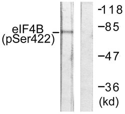 Phospho-eIF4B (Ser422) Polyclonal Antibody, Invitrogen 100 &mu;g; Unconjugated:Antibodies,
