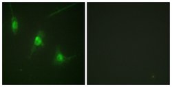 Phospho-MSK1 (Ser360) Polyclonal Antibody, Invitrogen 100 μg; Unconjugated:Antibodies,