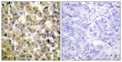 Phospho-MSK1 (Ser360) Polyclonal Antibody, Invitrogen 100 μg; Unconjugated:Antibodies,