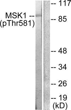 Phospho-MSK1 (Thr581) Polyclonal Antibody, Invitrogen 100 &mu;g; Unconjugated:Antibodies,