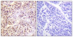 Phospho-MST1/MST2 (Thr183) Polyclonal Antibody, Invitrogen 100 &mu;g; Unconjugated:Antibodies,