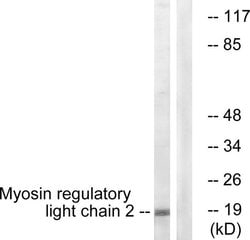 MRLC2 Polyclonal Antibody, Invitrogen 100 &mu;g | Buy Online | Invitrogen | Fisher Scientific