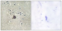 Phospho-PLCB3 (Ser537) Polyclonal Antibody, Invitrogen 100 μg; Unconjugated:Antibodies,
