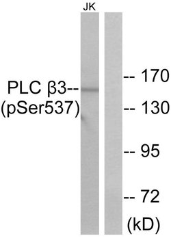 Phospho-PLCB3 (Ser537) Polyclonal Antibody, Invitrogen 100 μg; Unconjugated:Antibodies,