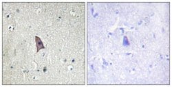 Invitrogen Phospho-TEK (Tyr1102) Polyclonal Antibody 100 &mu;g; Unconjugated:Antibodies,