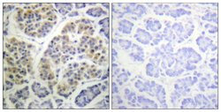 Phospho-14-3-3 theta (Ser232) Polyclonal Antibody, Invitrogen 100 &mu;g;