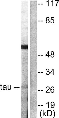 14-3-3 theta Polyclonal Antibody, Invitrogen 100 &mu;g; Unconjugated:Antibodies,