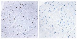 Phospho-53BP1 (Ser6) Polyclonal Antibody, Invitrogen 100 &mu;g | Buy Online | Invitrogen | Fisher Scientific