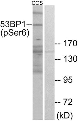 Phospho-53BP1 (Ser6) Polyclonal Antibody, Invitrogen 100 &mu;g | Buy Online | Invitrogen | Fisher Scientific