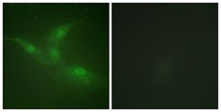 Phospho-BRK (Tyr447) Polyclonal Antibody, Invitrogen 100 &mu;g; Unconjugated:Antibodies,