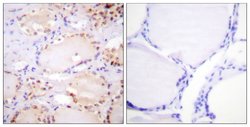 Phospho-ETK (Tyr566) Polyclonal Antibody, Invitrogen 100 &mu;g; Unconjugated:Antibodies,