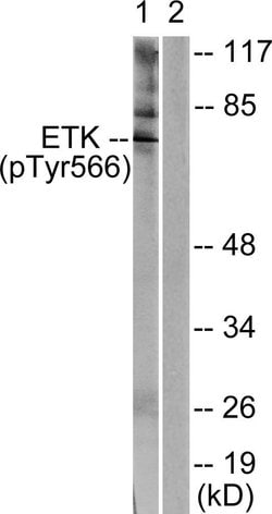 Phospho-ETK (Tyr566) Polyclonal Antibody, Invitrogen 100 &mu;g; Unconjugated:Antibodies,