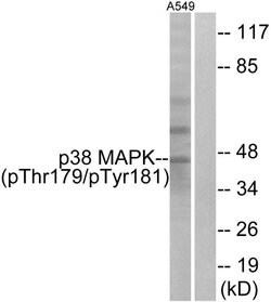 Phospho-p38 MAPK (Thr179, Tyr181) Polyclonal Antibody, Invitrogen 100 &mu;g;