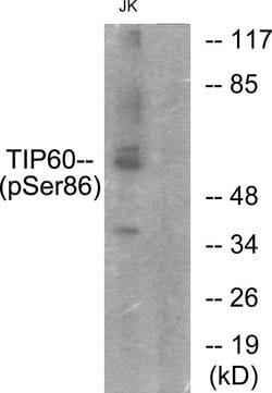 Phospho-TIP60 (Ser86) Polyclonal Antibody, Invitrogen 100 &mu;g; Unconjugated:Antibodies,