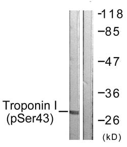 Phospho-Cardiac Troponin I (Ser43) Polyclonal Antibody, Invitrogen 100 &mu;g | Buy Online | Invitrogen | Fisher Scientific