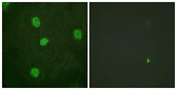 Phospho-B-Myb (Ser577, Ser581) Polyclonal Antibody, Invitrogen 100 &mu;g;