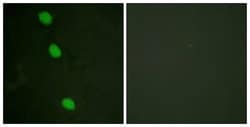 Phospho-CaMKIV (Thr196, Thr200) Polyclonal Antibody, Invitrogen 100 &mu;g;