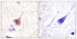 Phospho-CaMKIV (Thr196, Thr200) Polyclonal Antibody, Invitrogen 100 &mu;g;