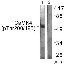 Phospho-CaMKIV (Thr196, Thr200) Polyclonal Antibody, Invitrogen 100 &mu;g;