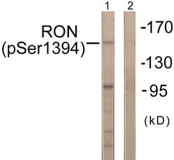 Phospho-RON (Ser1394) Polyclonal Antibody, Invitrogen 100 &mu;g | Buy Online | Invitrogen | Fisher Scientific